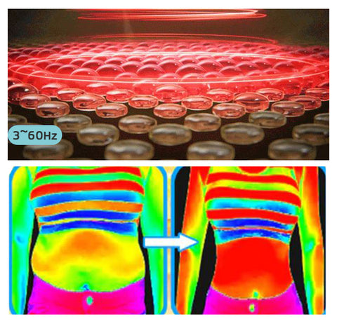 🔥Slimoly™ Matteo Ultrasonic Body Shape Wristband Pro 🔥