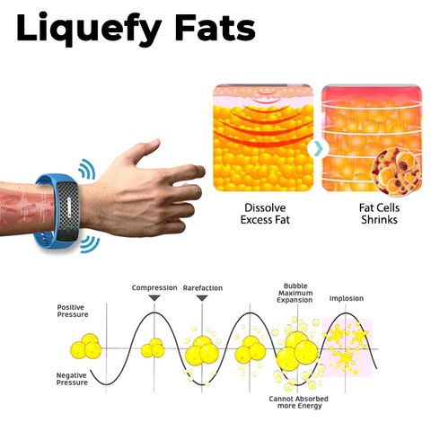 🔥Slimoly™ Matteo Ultrasonic Body Shape Wristband Pro 🔥